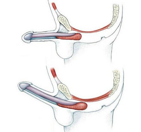 Pubococygeus muscle and then exercise penis